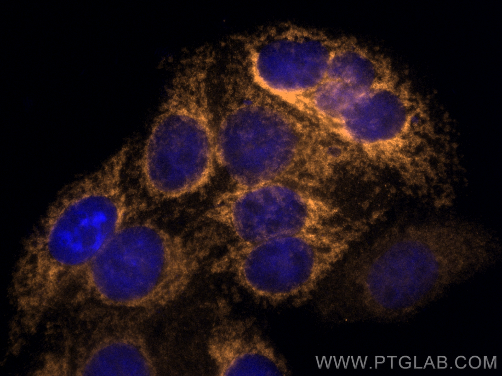 Immunofluorescence (IF) / fluorescent staining of HepG2 cells using CoraLite®555-conjugated CPT1A Polyclonal antibody (CL555-15184)