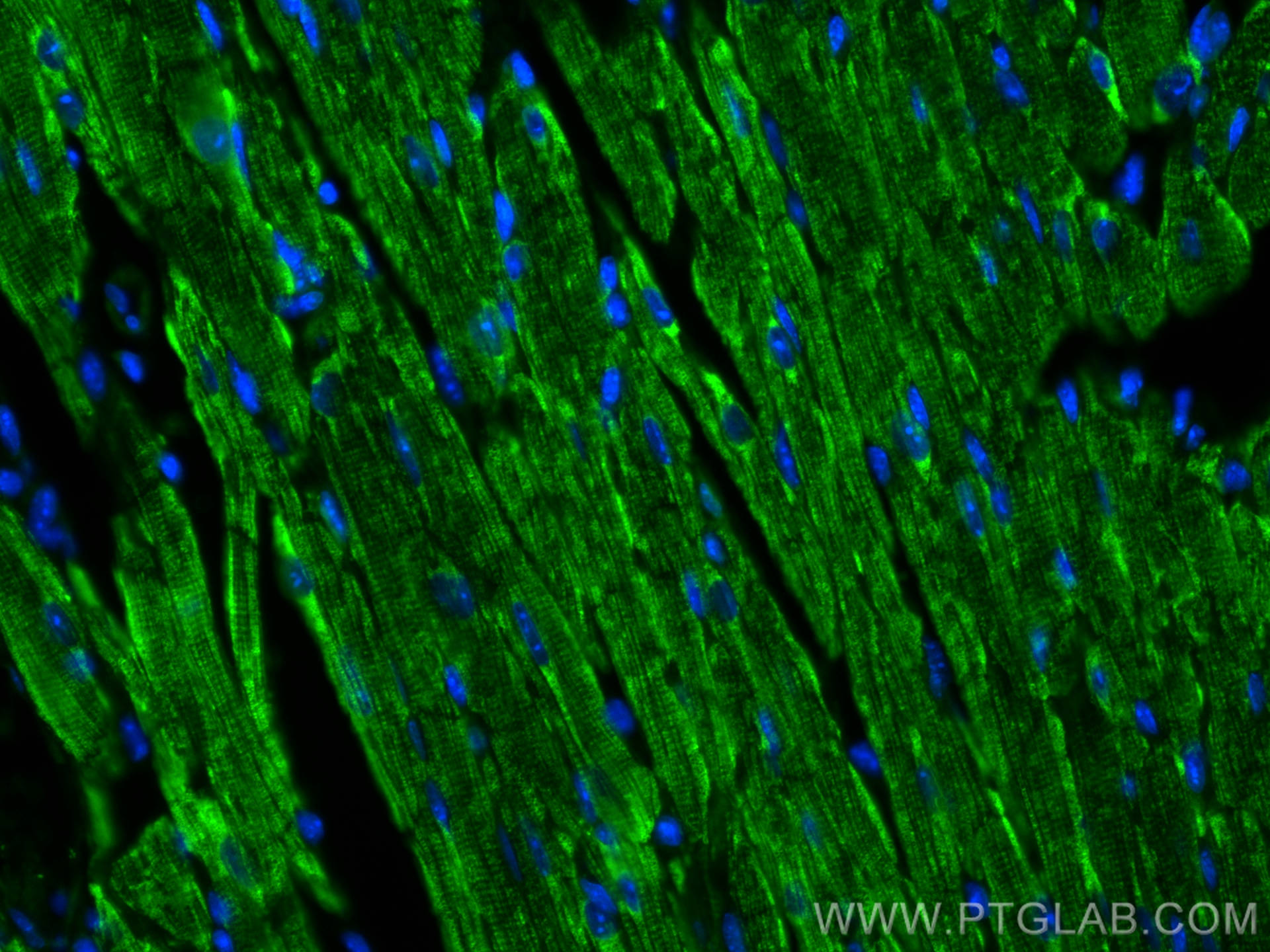 Immunofluorescence (IF) / fluorescent staining of mouse heart tissue using CPT1B-specific Polyclonal antibody (22170-1-AP)