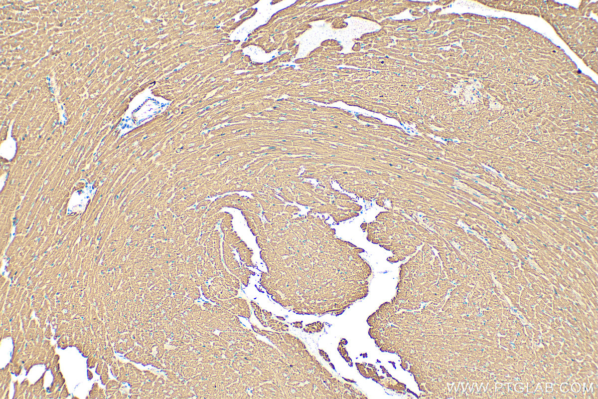Immunohistochemistry (IHC) staining of mouse heart tissue using CPT1B-specific Polyclonal antibody (22170-1-AP)