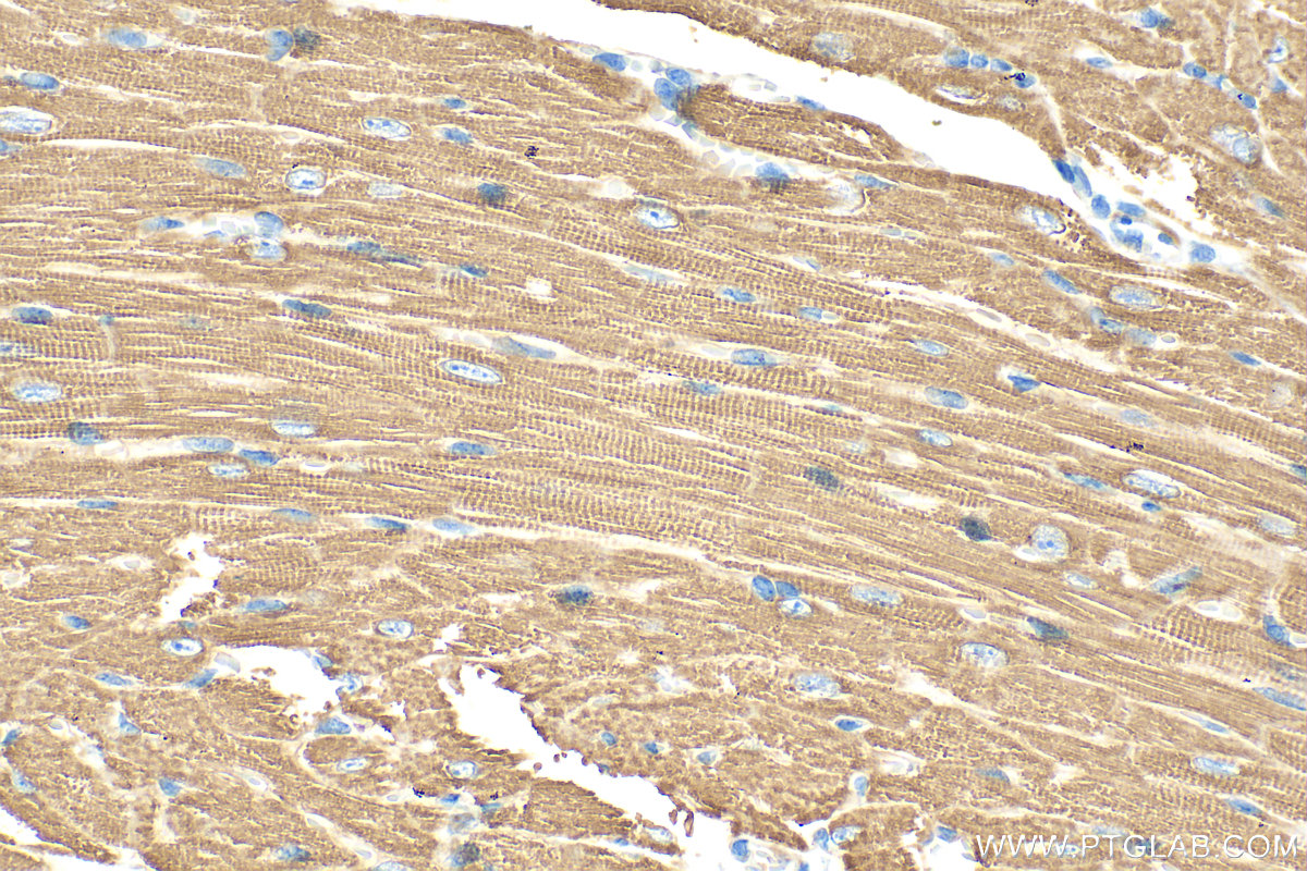 Immunohistochemistry (IHC) staining of mouse heart tissue using CPT1B-specific Polyclonal antibody (22170-1-AP)