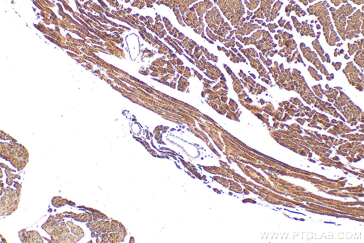 Immunohistochemistry (IHC) staining of mouse heart tissue using CPT1B-specific Polyclonal antibody (22170-1-AP)