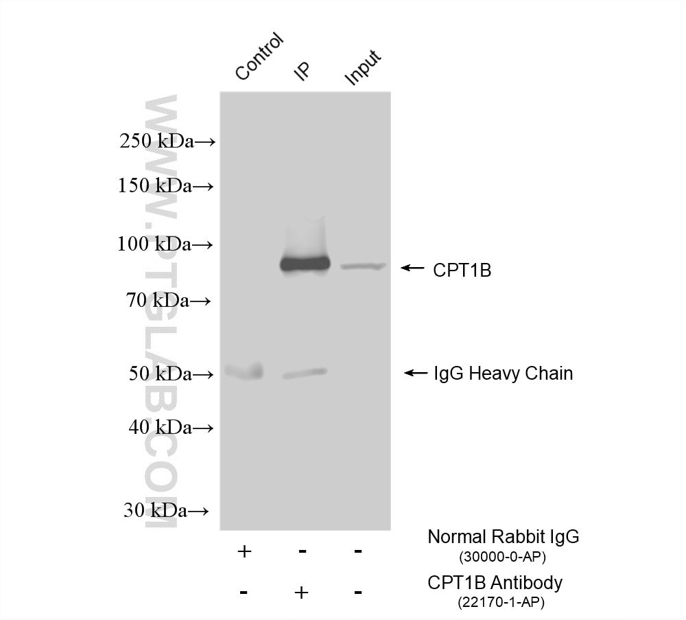Immunoprecipitation (IP) experiment of mouse heart tissue using CPT1B-specific Polyclonal antibody (22170-1-AP)