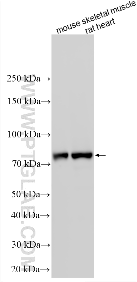 Western Blot (WB) analysis of various lysates using CPT1B-specific Polyclonal antibody (22170-1-AP)