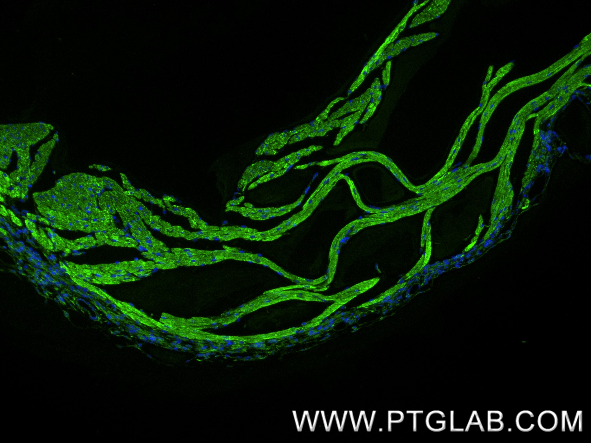 Immunofluorescence (IF) / fluorescent staining of mouse heart tissue using CPT1B Recombinant antibody (82701-3-RR)