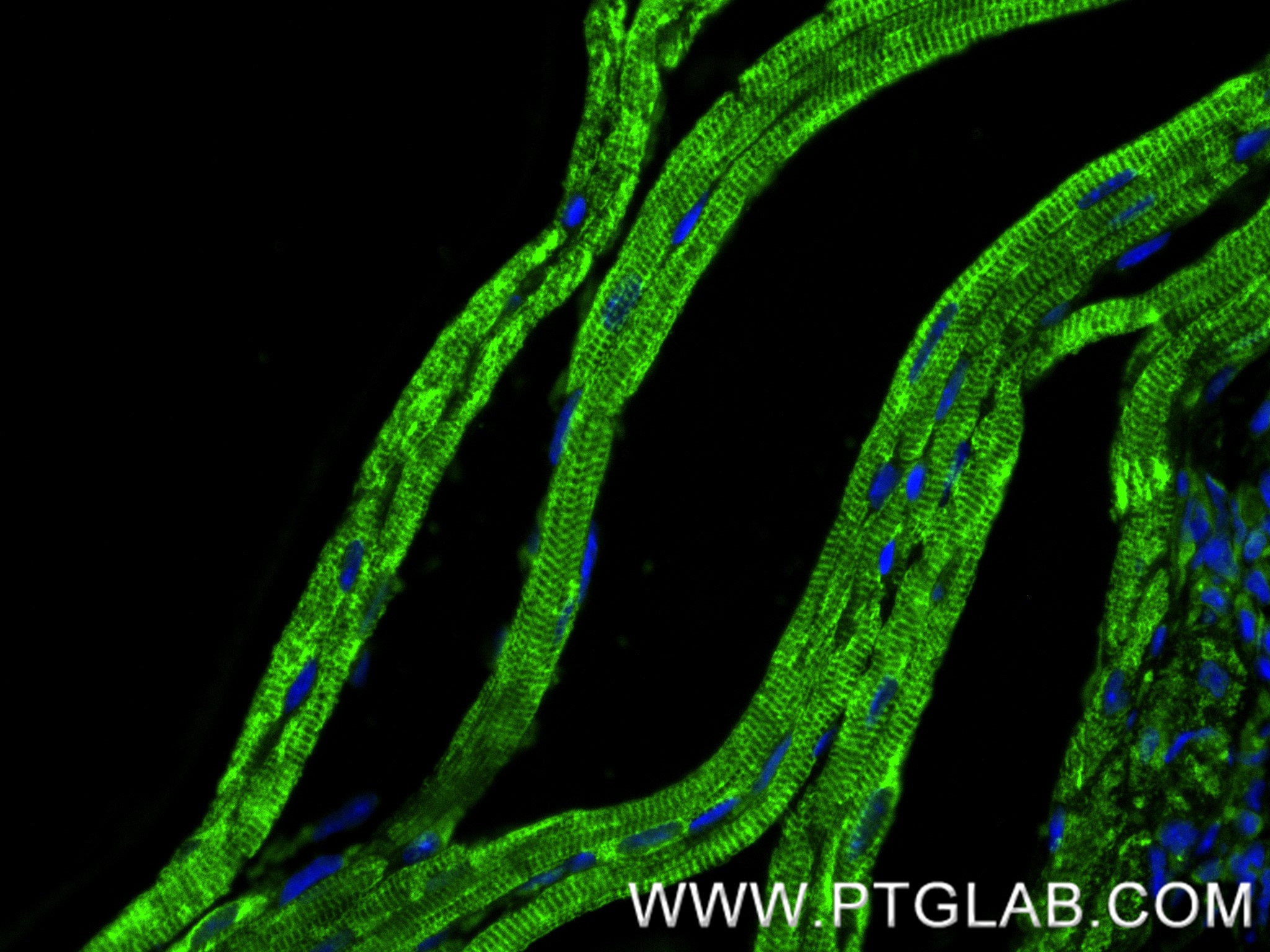 Immunofluorescence (IF) / fluorescent staining of mouse heart tissue using CPT1B Recombinant antibody (82701-3-RR)