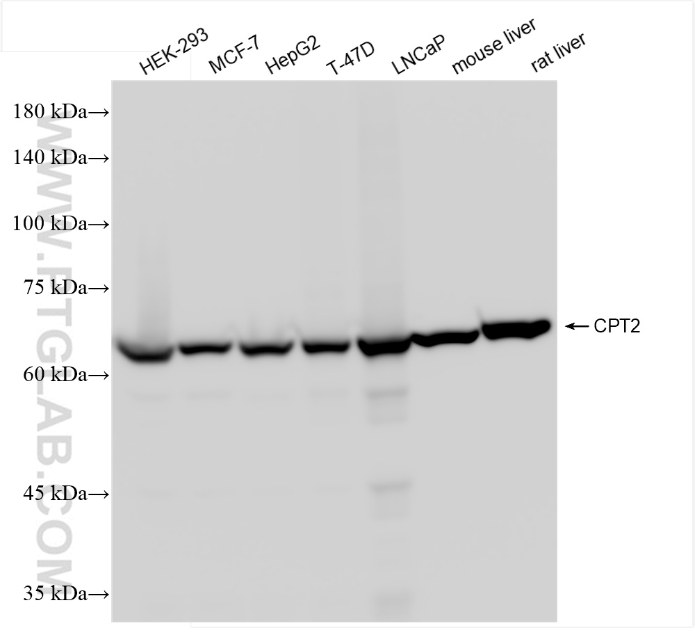 Western Blot (WB) analysis of various lysates using CPT2 Recombinant antibody (85013-4-RR)