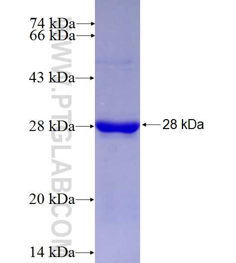 CPXM1 fusion protein Ag27357 SDS-PAGE