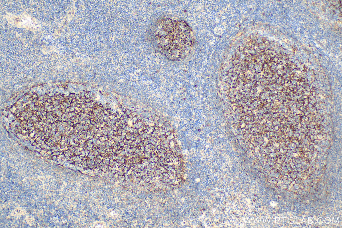 Immunohistochemistry (IHC) staining of human tonsillitis tissue using CD35 Monoclonal antibody (68033-1-Ig)