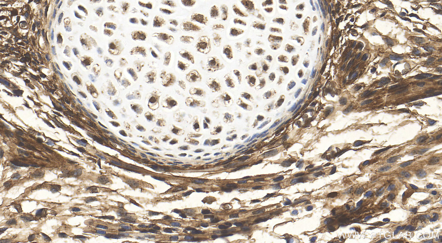 Immunohistochemistry (IHC) staining of mouse embryo tissue using CRABP2 Polyclonal antibody (10225-1-AP)