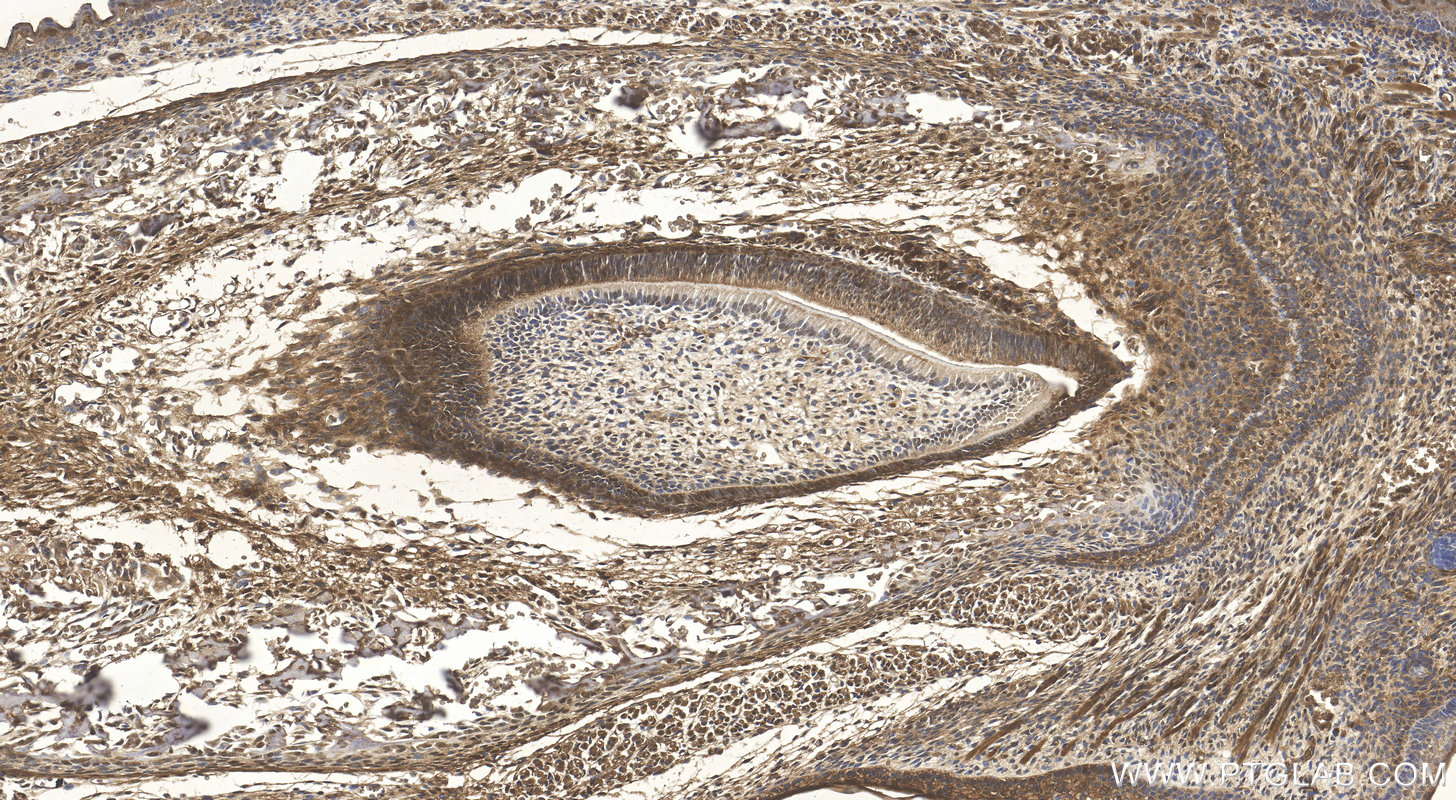 Immunohistochemistry (IHC) staining of mouse embryo tissue using CRABP2 Polyclonal antibody (10225-1-AP)