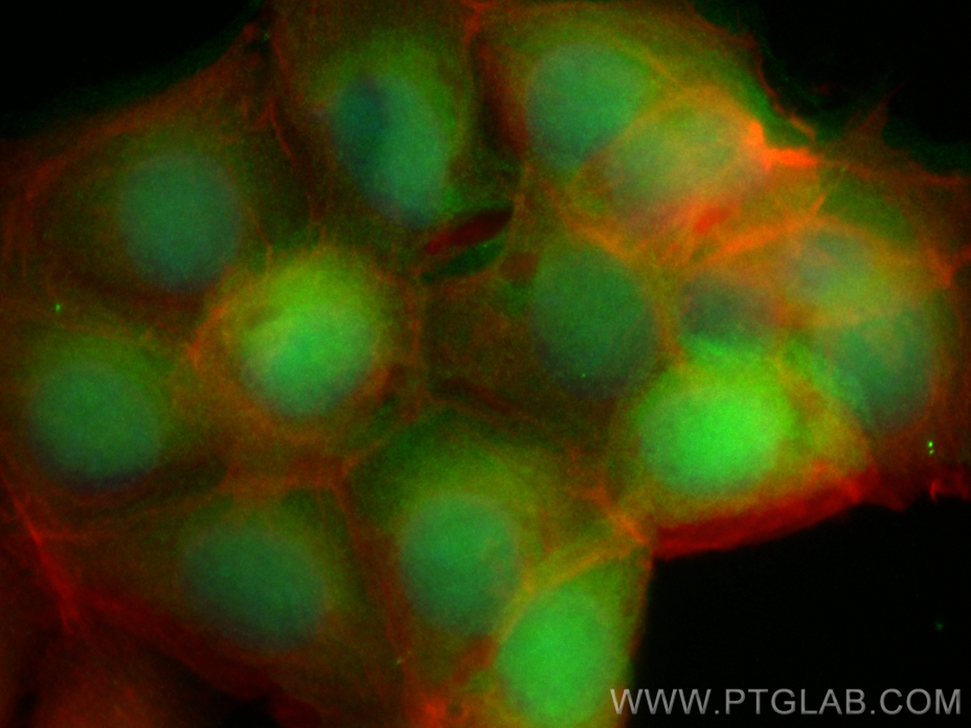 Immunofluorescence (IF) / fluorescent staining of MCF-7 cells using CoraLite® Plus 488-conjugated CRABP2 Monoclonal an (CL488-66468)