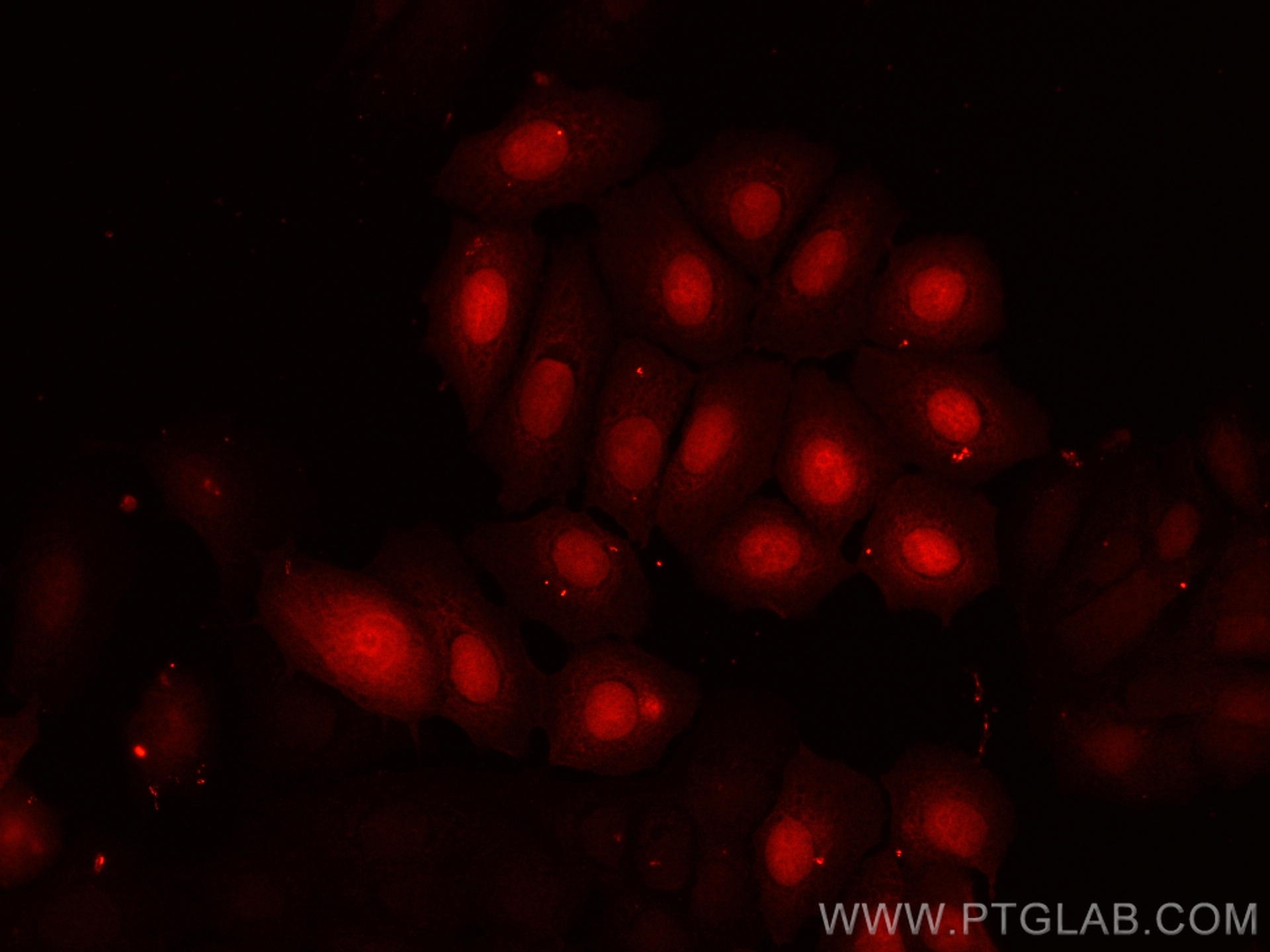 Immunofluorescence (IF) / fluorescent staining of MCF-7 cells using CoraLite®594-conjugated CRABP2 Polyclonal antibody (CL594-10225)