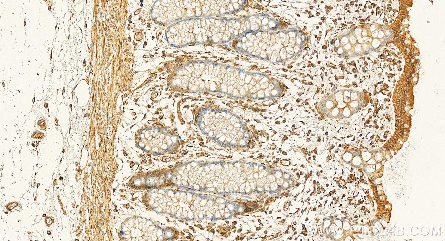 Immunohistochemistry (IHC) staining of human colon tissue using CRACR2A Monoclonal antibody (66787-1-Ig)