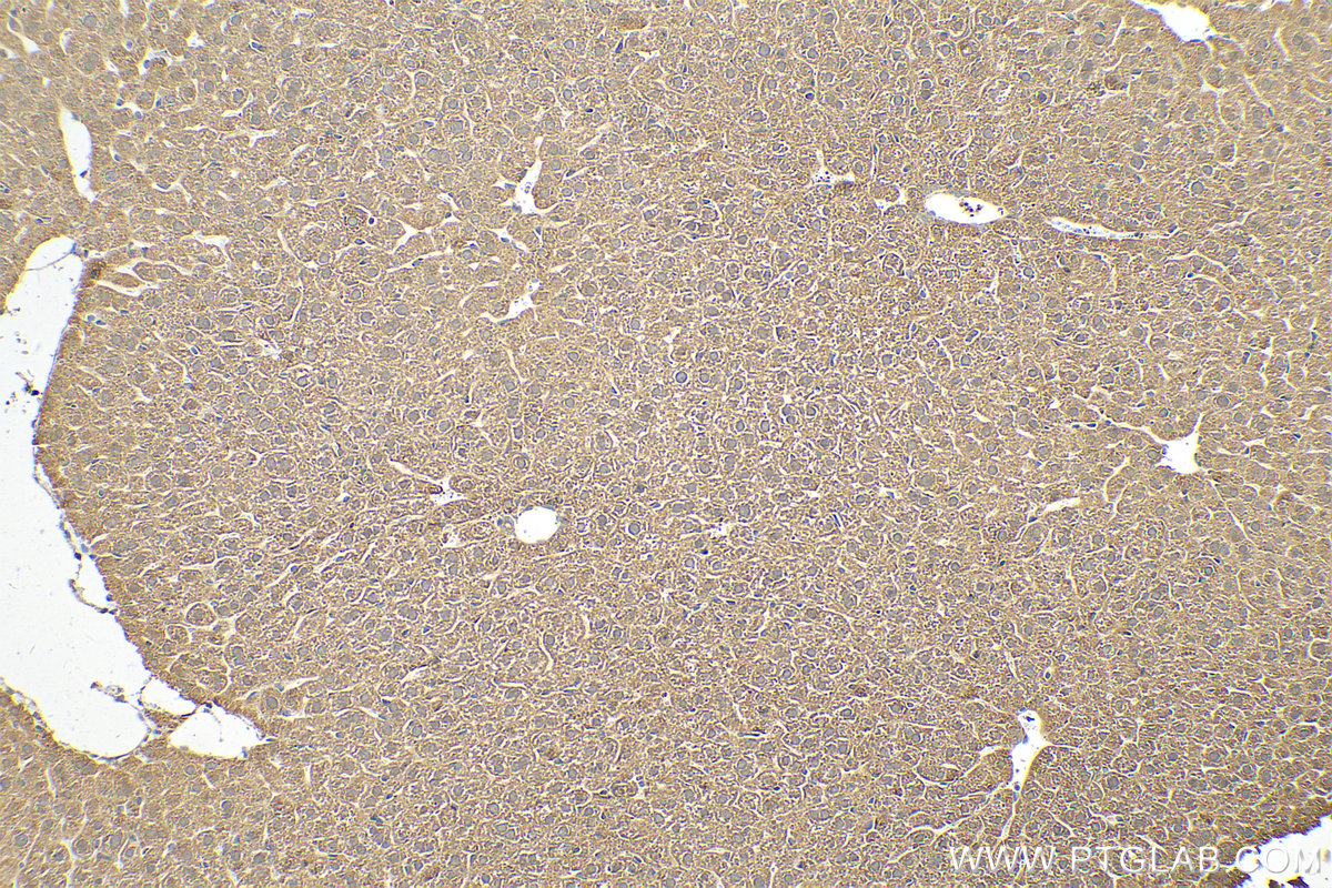 Immunohistochemistry (IHC) staining of mouse liver tissue using CRAT Polyclonal antibody (15170-1-AP)