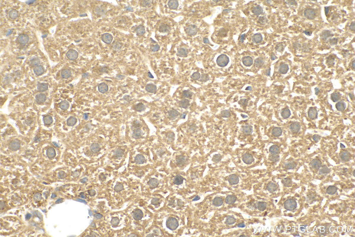 Immunohistochemistry (IHC) staining of mouse liver tissue using CRAT Polyclonal antibody (15170-1-AP)