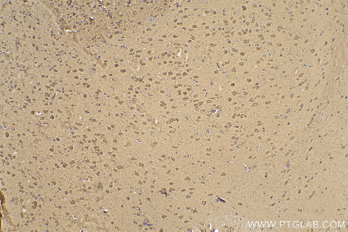 Immunohistochemistry (IHC) staining of mouse brain tissue using CRAT Polyclonal antibody (15170-1-AP)