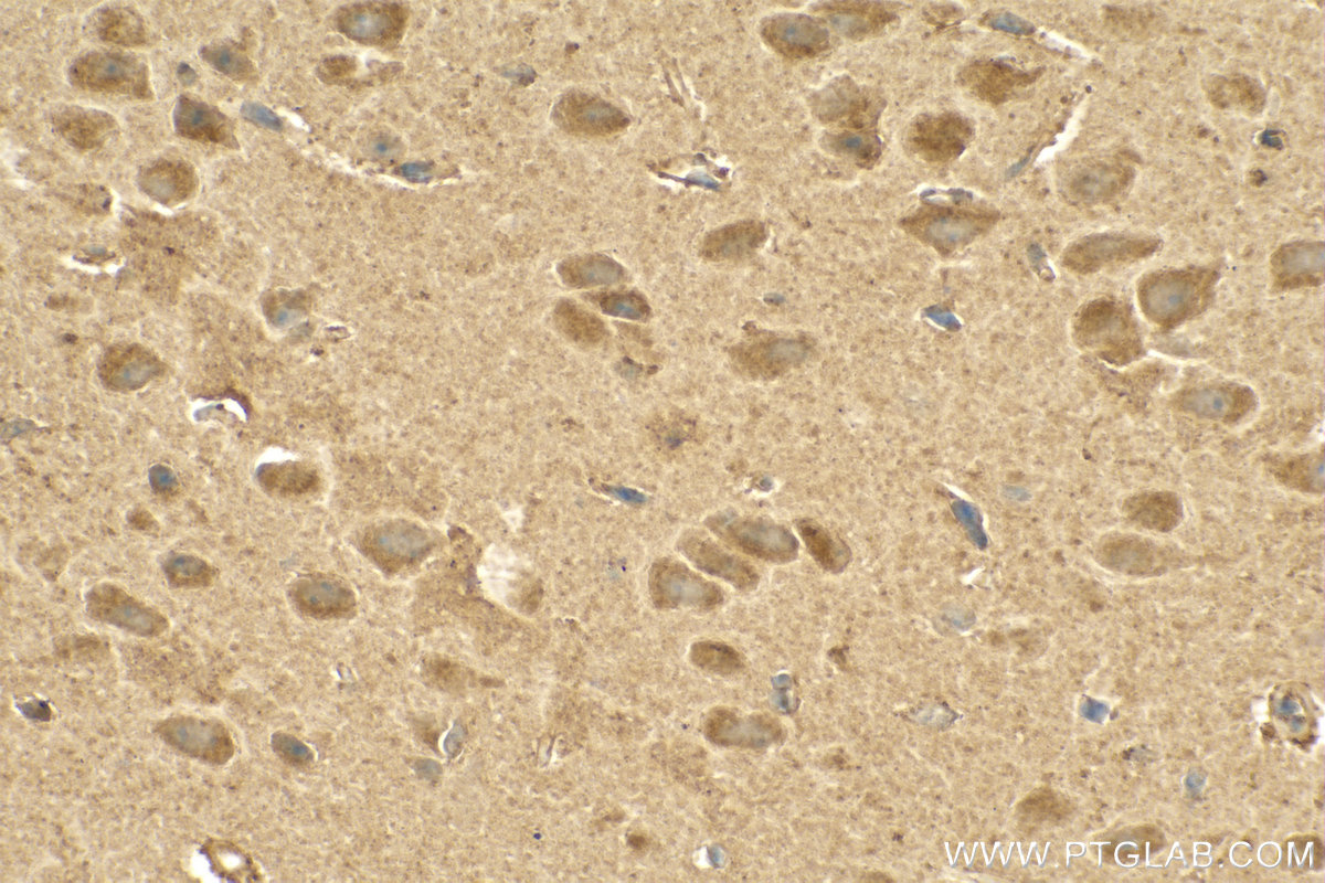 Immunohistochemistry (IHC) staining of mouse brain tissue using CRAT Polyclonal antibody (15170-1-AP)