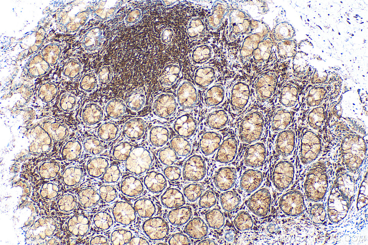 Immunohistochemistry (IHC) staining of human colon tissue using CRIP1 Recombinant antibody (83340-3-RR)