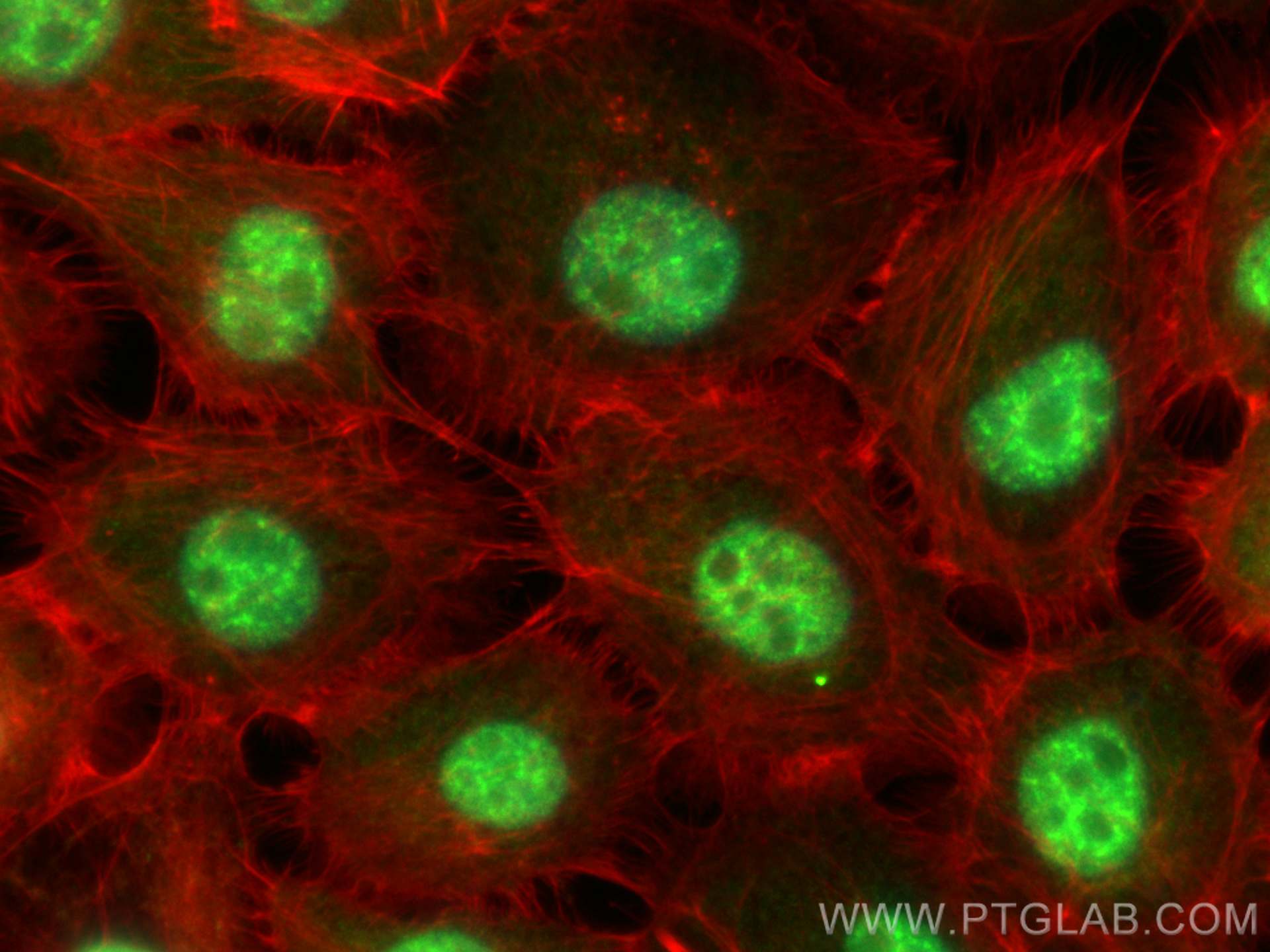 Immunofluorescence (IF) / fluorescent staining of A431 cells using CDK12/CRKRS Polyclonal antibody (26816-1-AP)