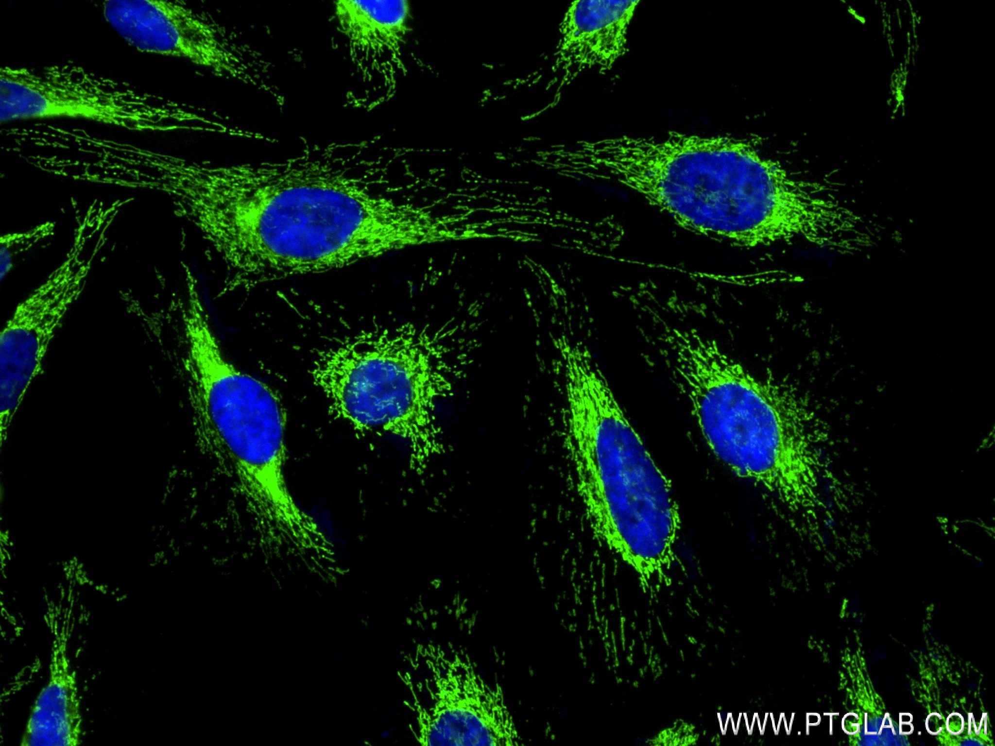 Immunofluorescence (IF) / fluorescent staining of Hela cells using CRLS1-Specific Recombinant antibody (84302-2-RR)