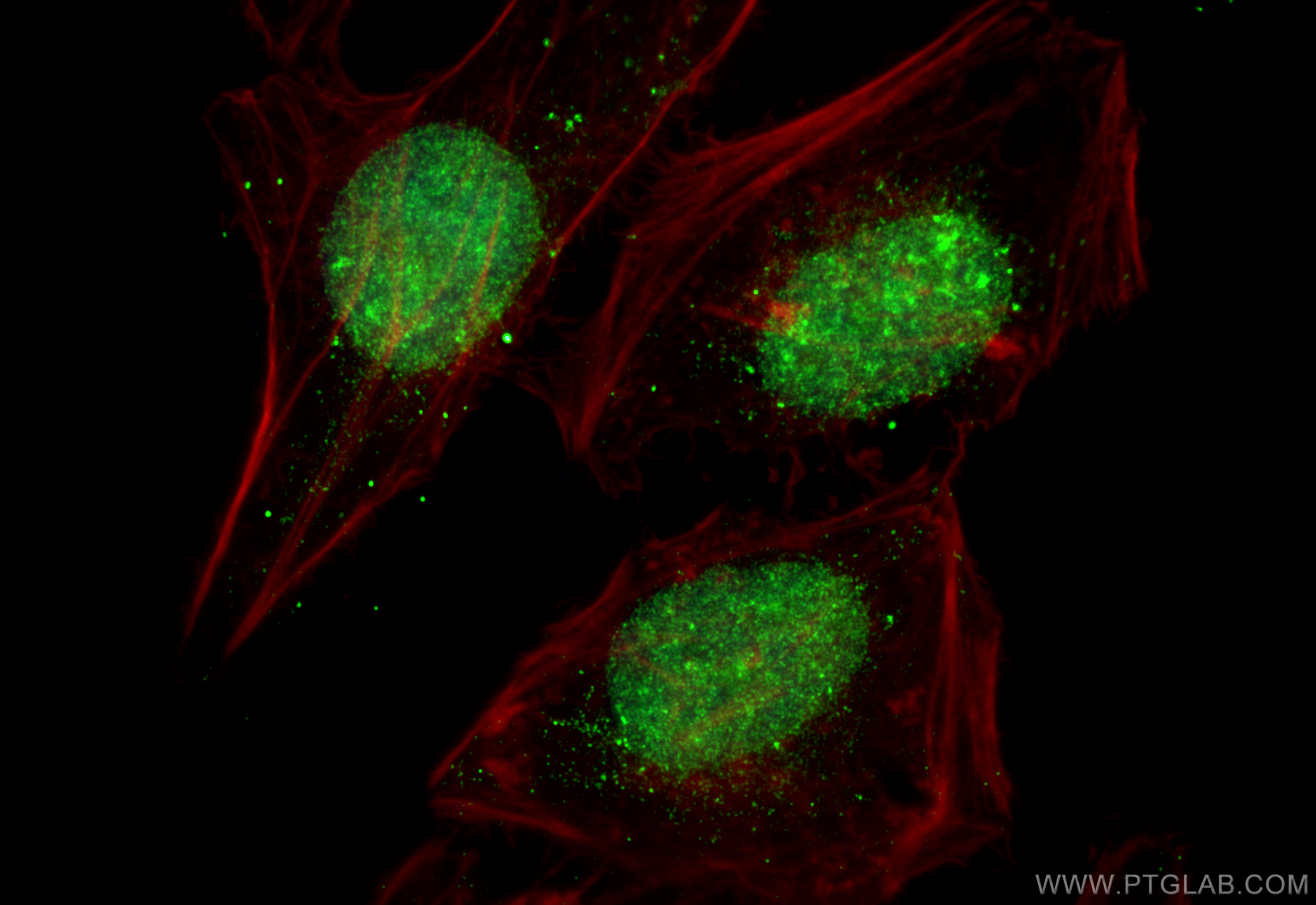 Immunofluorescence (IF) / fluorescent staining of HeLa cells using CRM1 Polyclonal antibody (27917-1-AP)