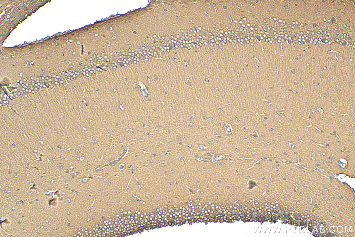 Immunohistochemistry (IHC) staining of mouse brain tissue using CRMP1 Polyclonal antibody (10317-1-AP)