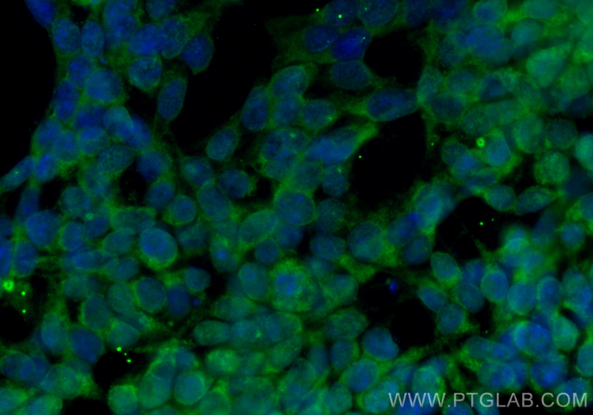 Immunofluorescence (IF) / fluorescent staining of SH-SY5Y cells using CoraLite® Plus 488-conjugated CRMP5 Monoclonal ant (CL488-68272)