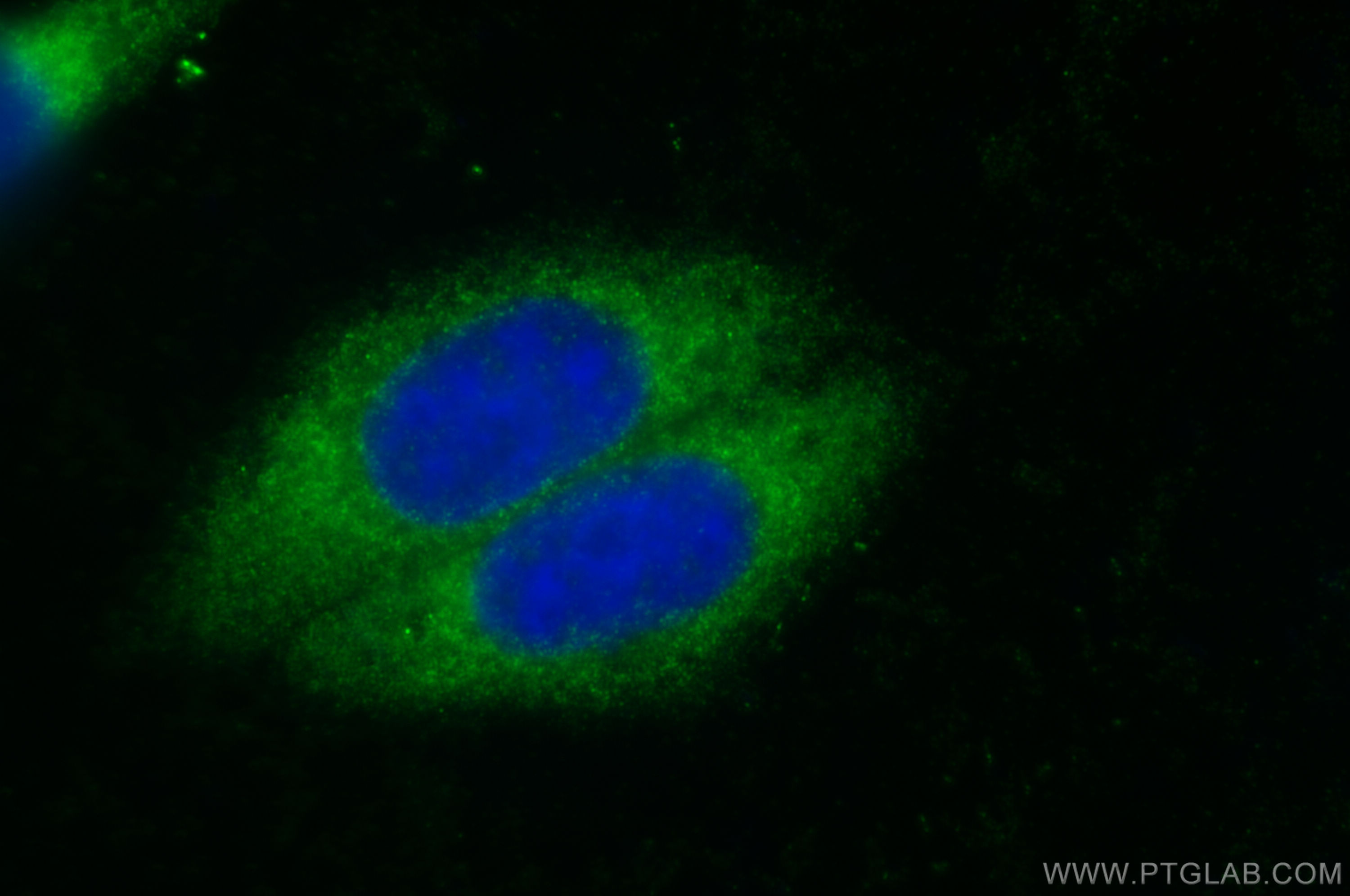 Immunofluorescence (IF) / fluorescent staining of HepG2 cells using CROT Polyclonal antibody (13543-1-AP)