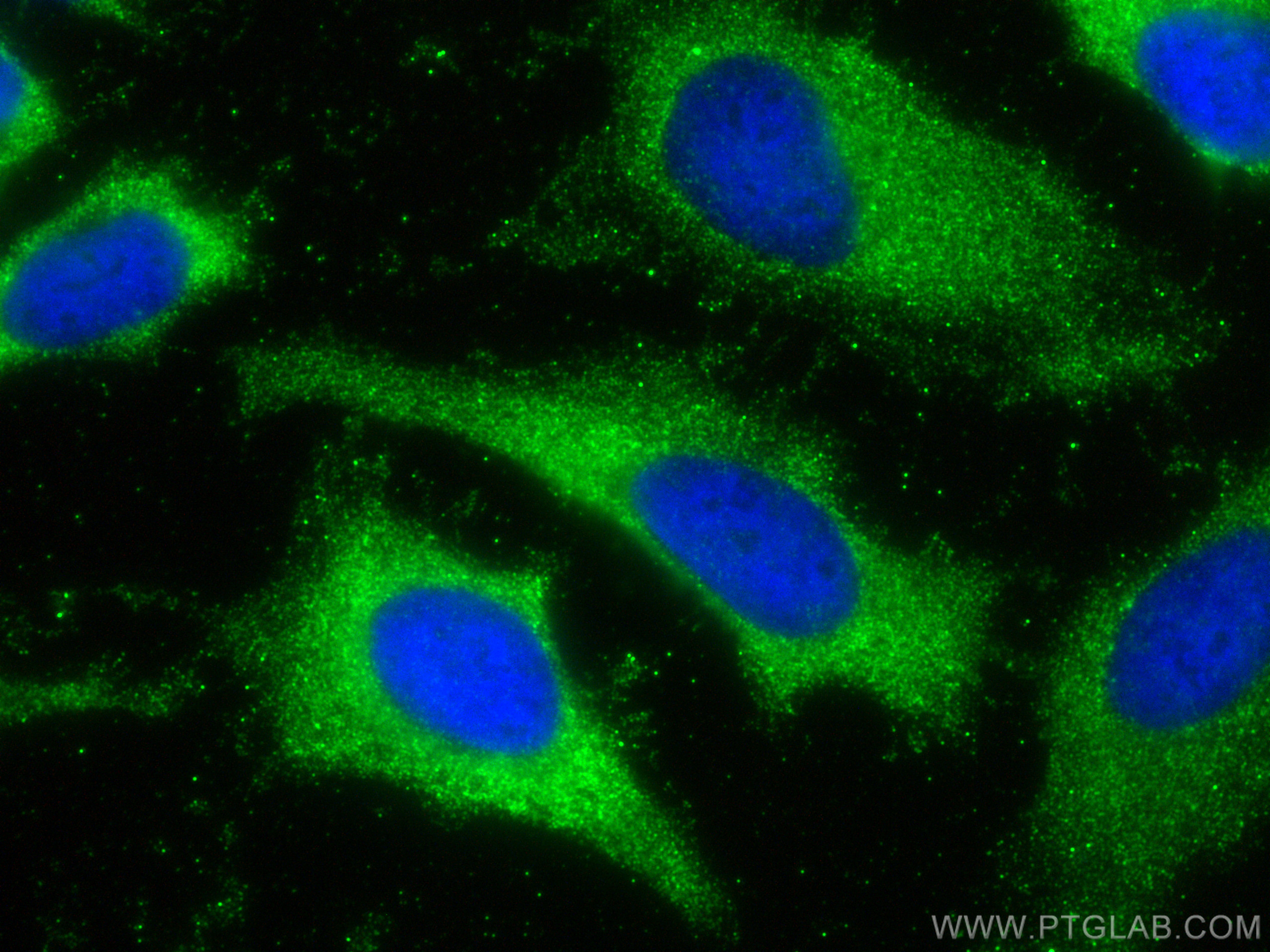 Immunofluorescence (IF) / fluorescent staining of HeLa cells using CRTAC1 Monoclonal antibody (68276-1-Ig)