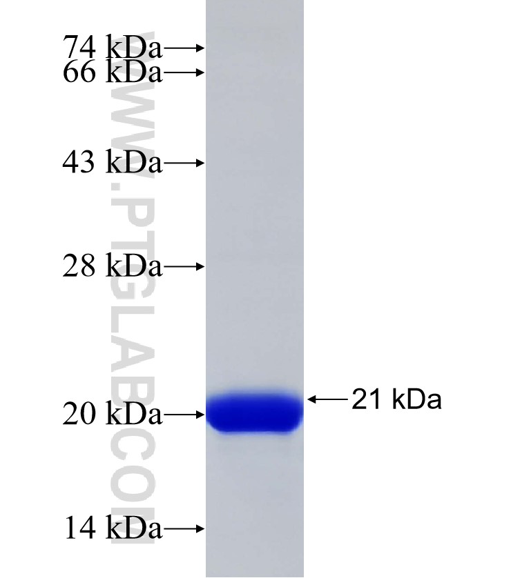 CRTAC1 fusion protein Ag32943 SDS-PAGE