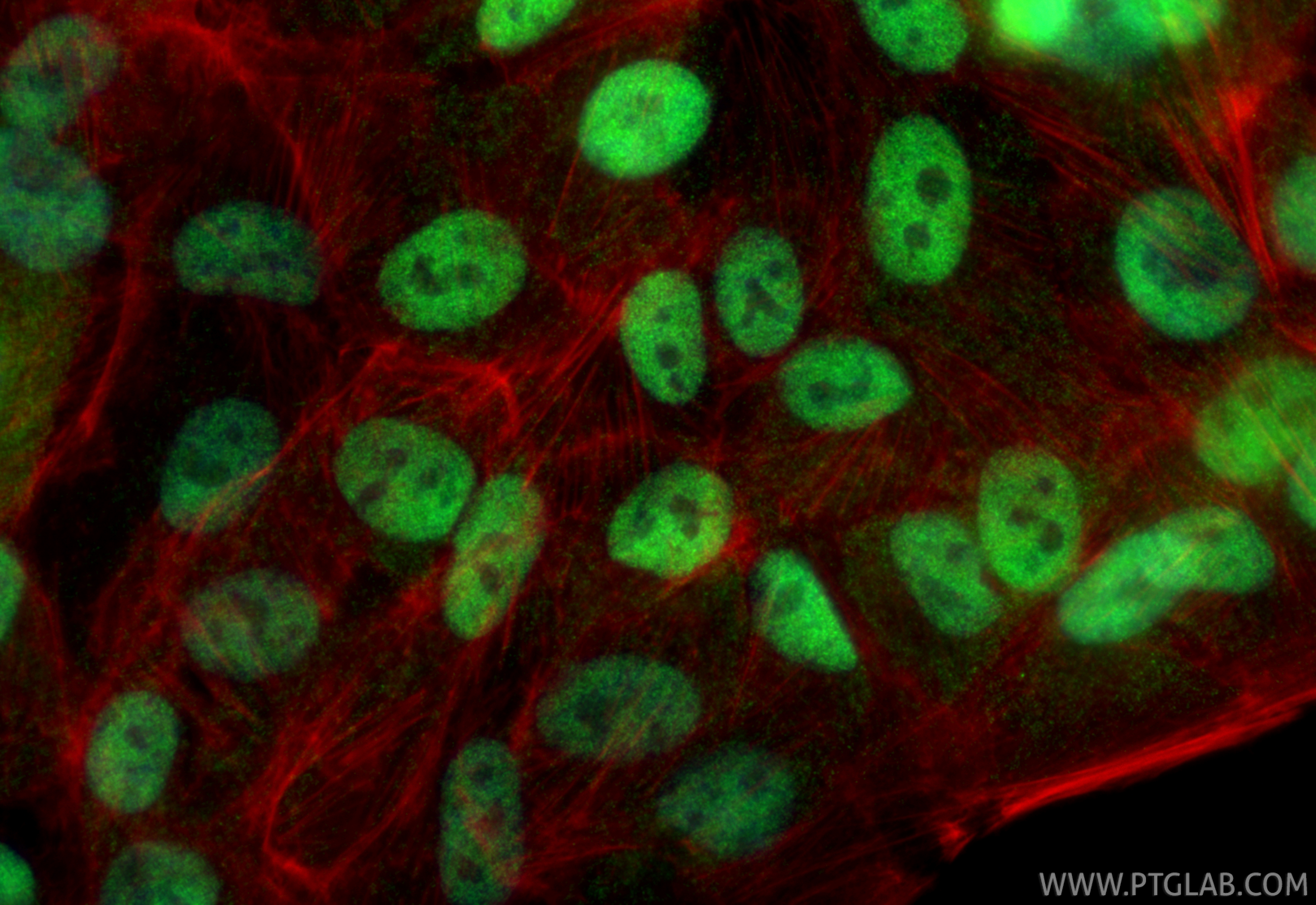 Immunofluorescence (IF) / fluorescent staining of hTERT-RPE1 cells using CRX Polyclonal antibody (12047-1-AP)