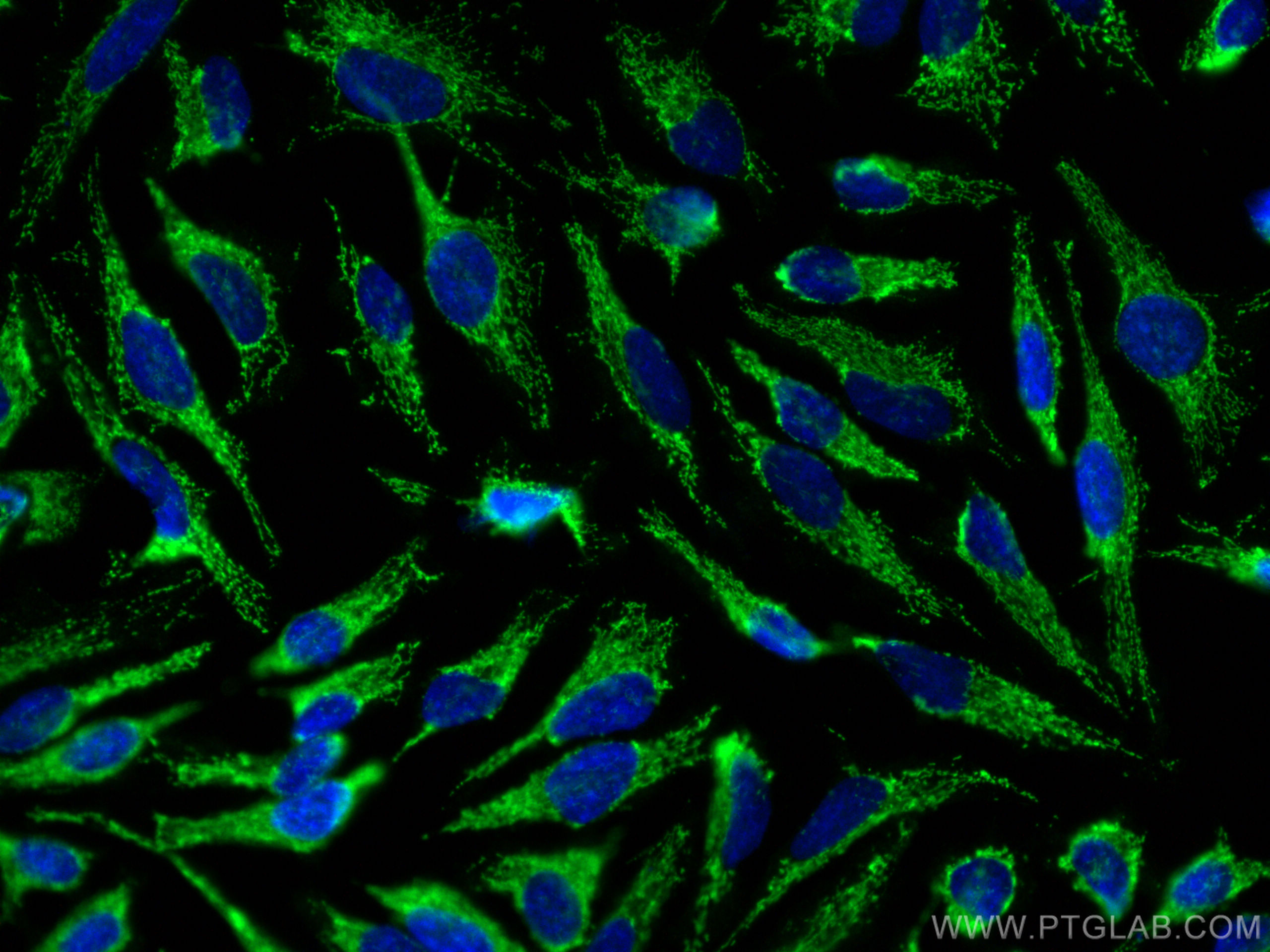 Immunofluorescence (IF) / fluorescent staining of HeLa cells using Cryptochrome 1 Polyclonal antibody (13474-1-AP)