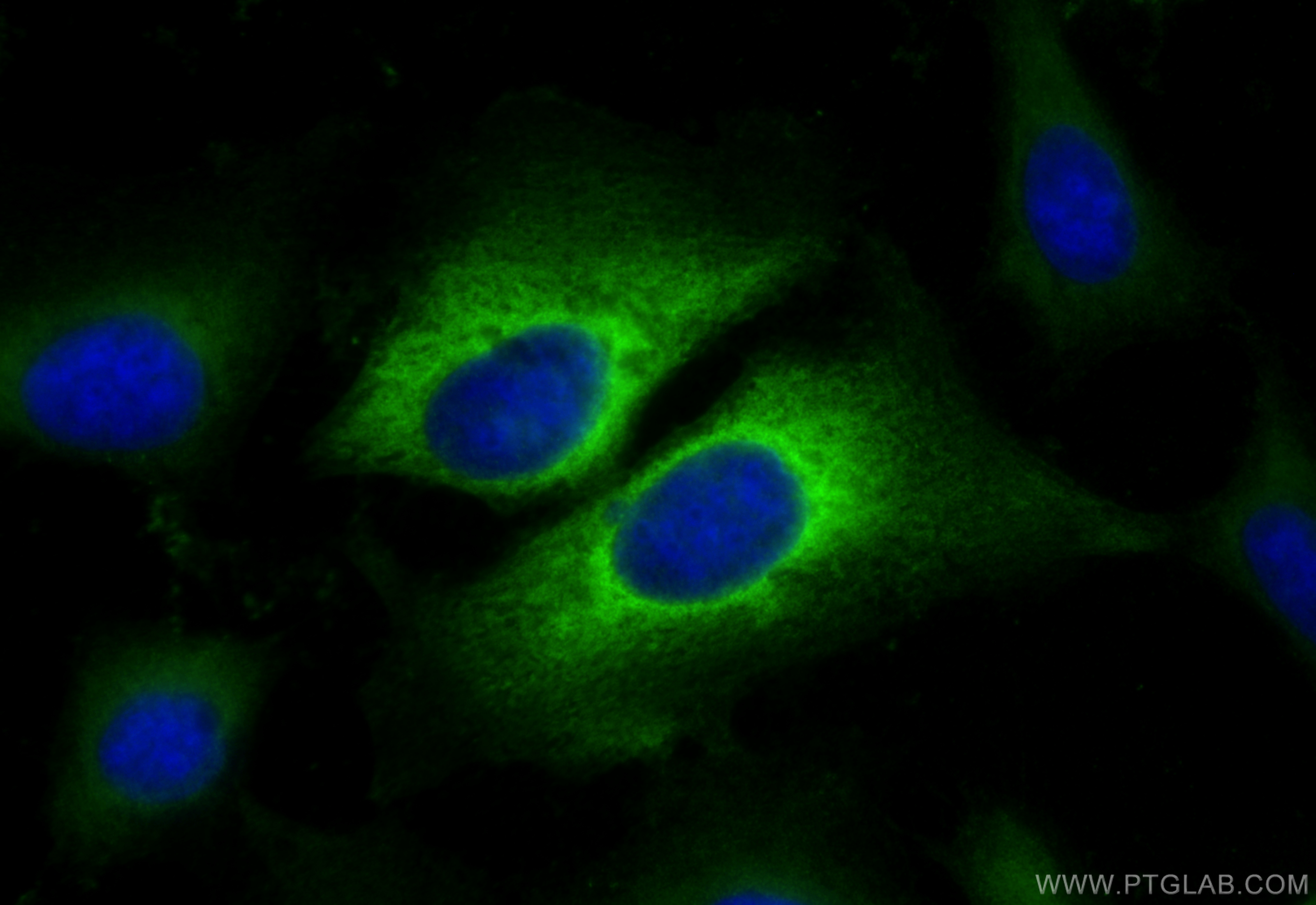 Immunofluorescence (IF) / fluorescent staining of U2OS cells using Alpha B Crystallin Polyclonal antibody (15808-1-AP)