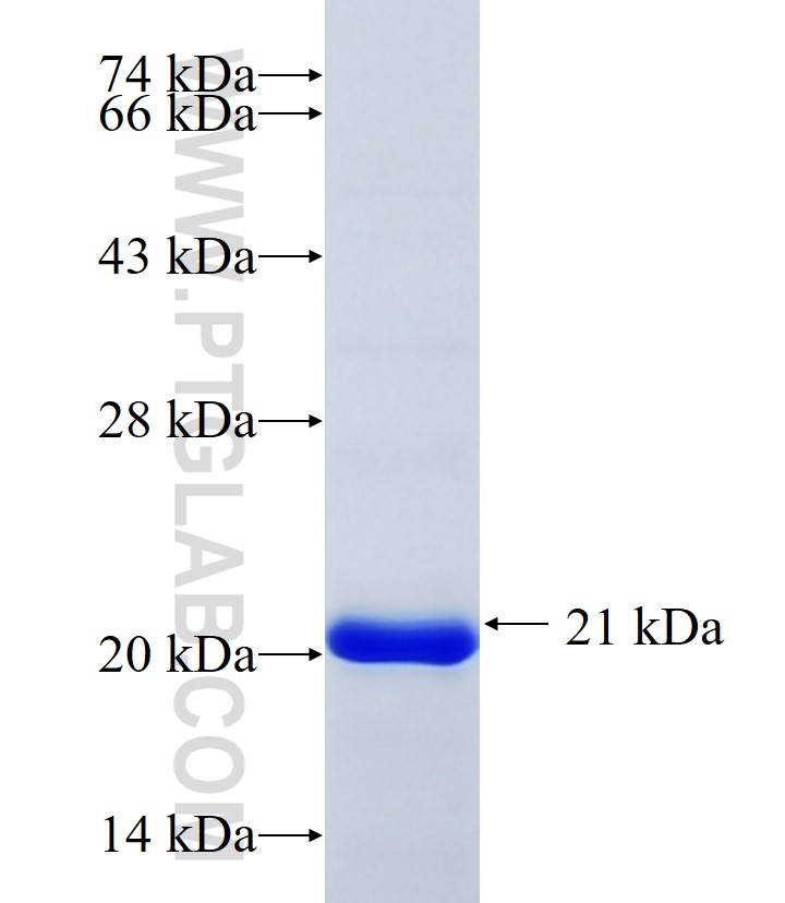 CSDA fusion protein Ag30109 SDS-PAGE