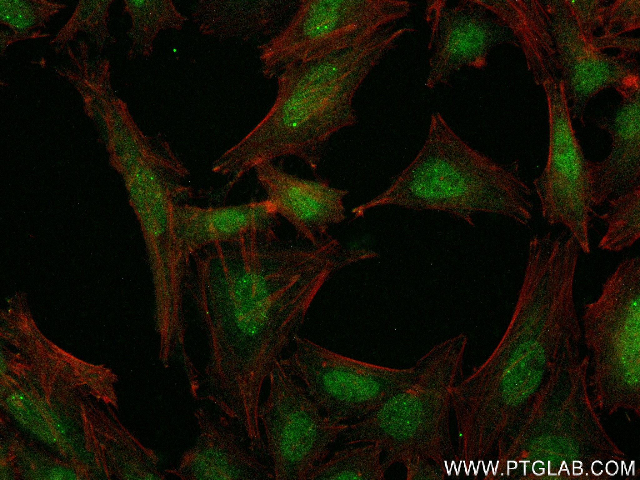 Immunofluorescence (IF) / fluorescent staining of HeLa cells using CSDC2 Recombinant antibody (83886-6-RR)