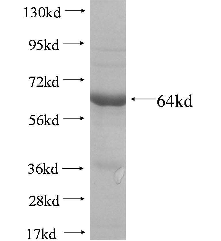 UNR; CSDE1 fusion protein Ag4349 SDS-PAGE