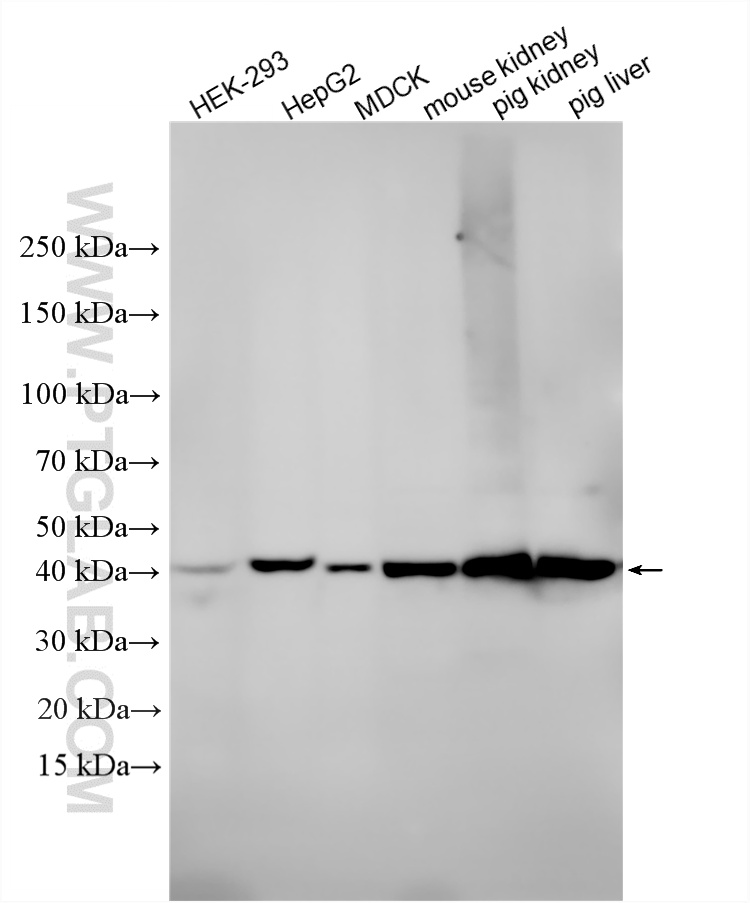 Western Blot (WB) analysis of various lysates using Gamma Cystathionase Monoclonal antibody (60234-1-Ig)
