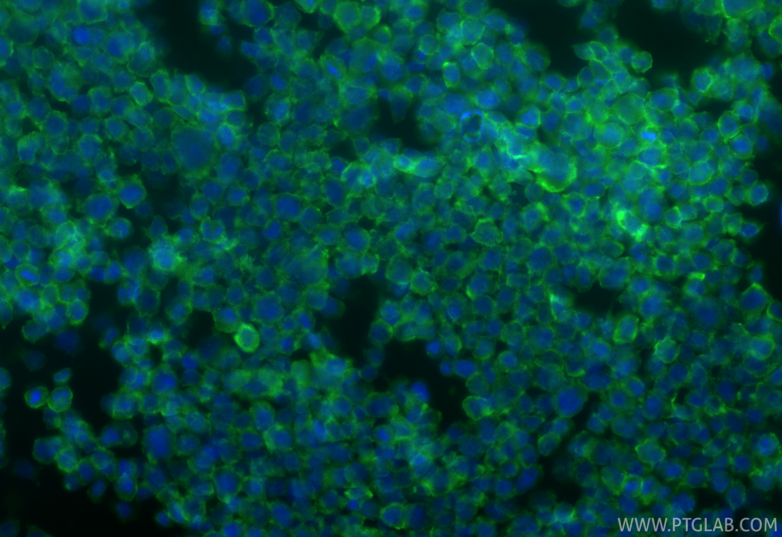 Immunofluorescence (IF) / fluorescent staining of THP-1 cells using CSF1R/CD115 Polyclonal antibody (25949-1-AP)