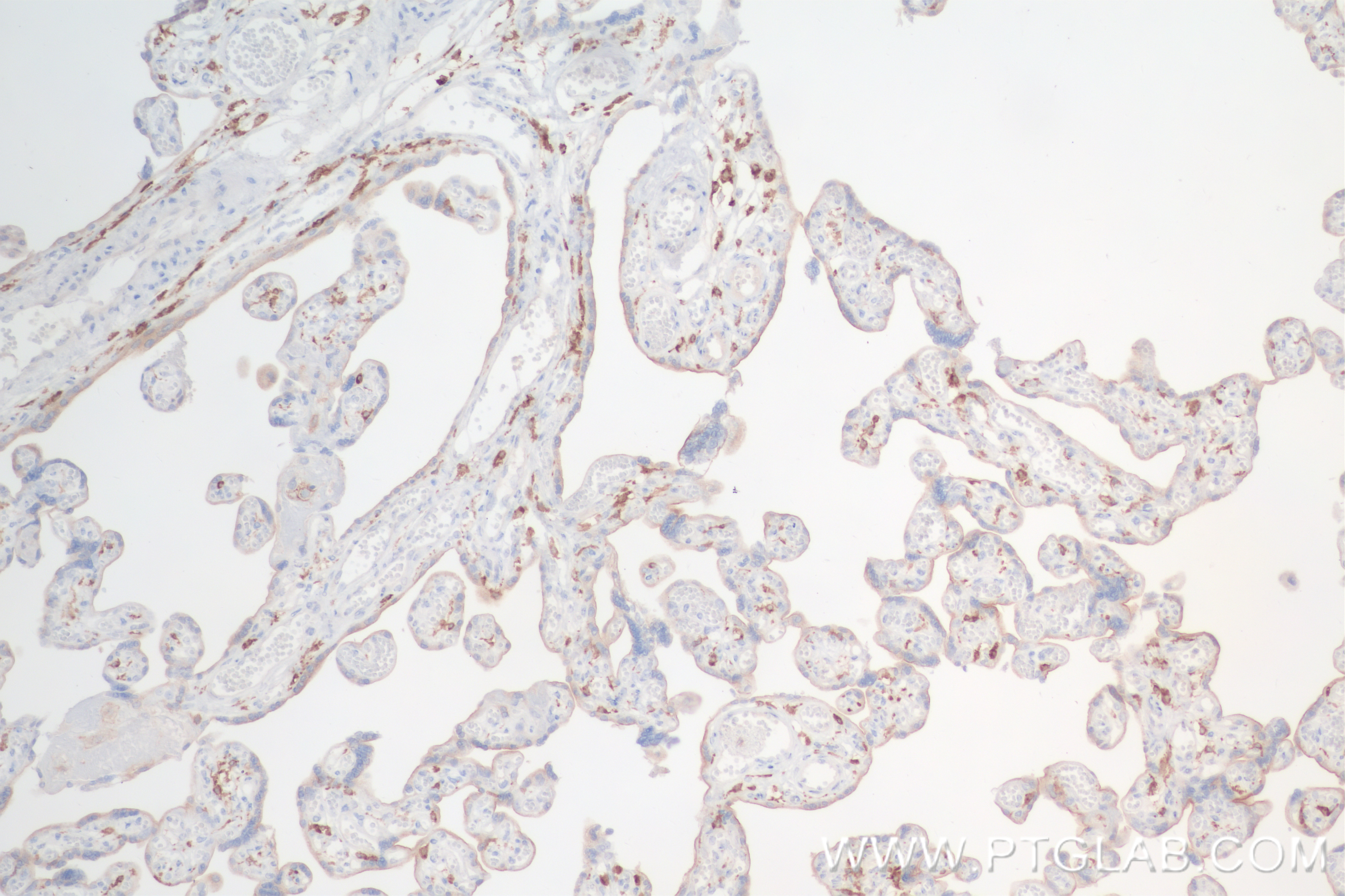 Immunohistochemistry (IHC) staining of human placenta tissue using CSF1R/CD115 Recombinant monoclonal antibody (84477-6-RR)