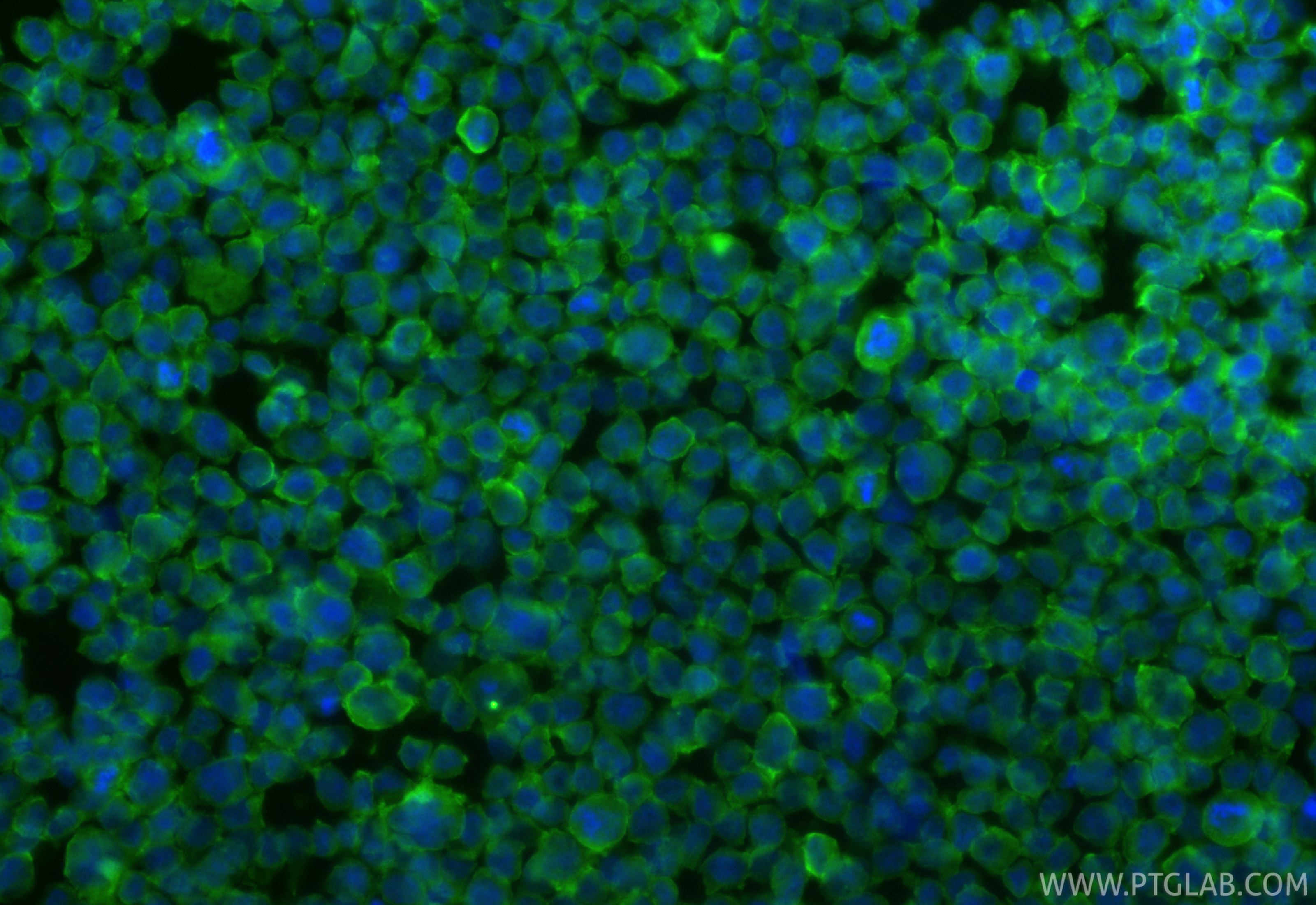 Immunofluorescence (IF) / fluorescent staining of THP-1 cells using CoraLite® Plus 488-conjugated CSF1R/CD115 Polyclon (CL488-25949)