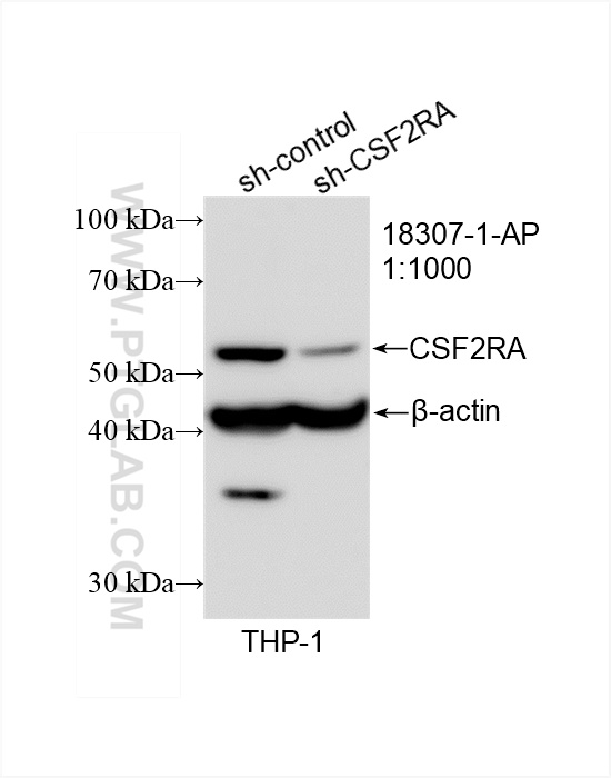 Western Blot (WB) analysis of THP-1 cells using CSF2RA/CD116 Polyclonal antibody (18307-1-AP)