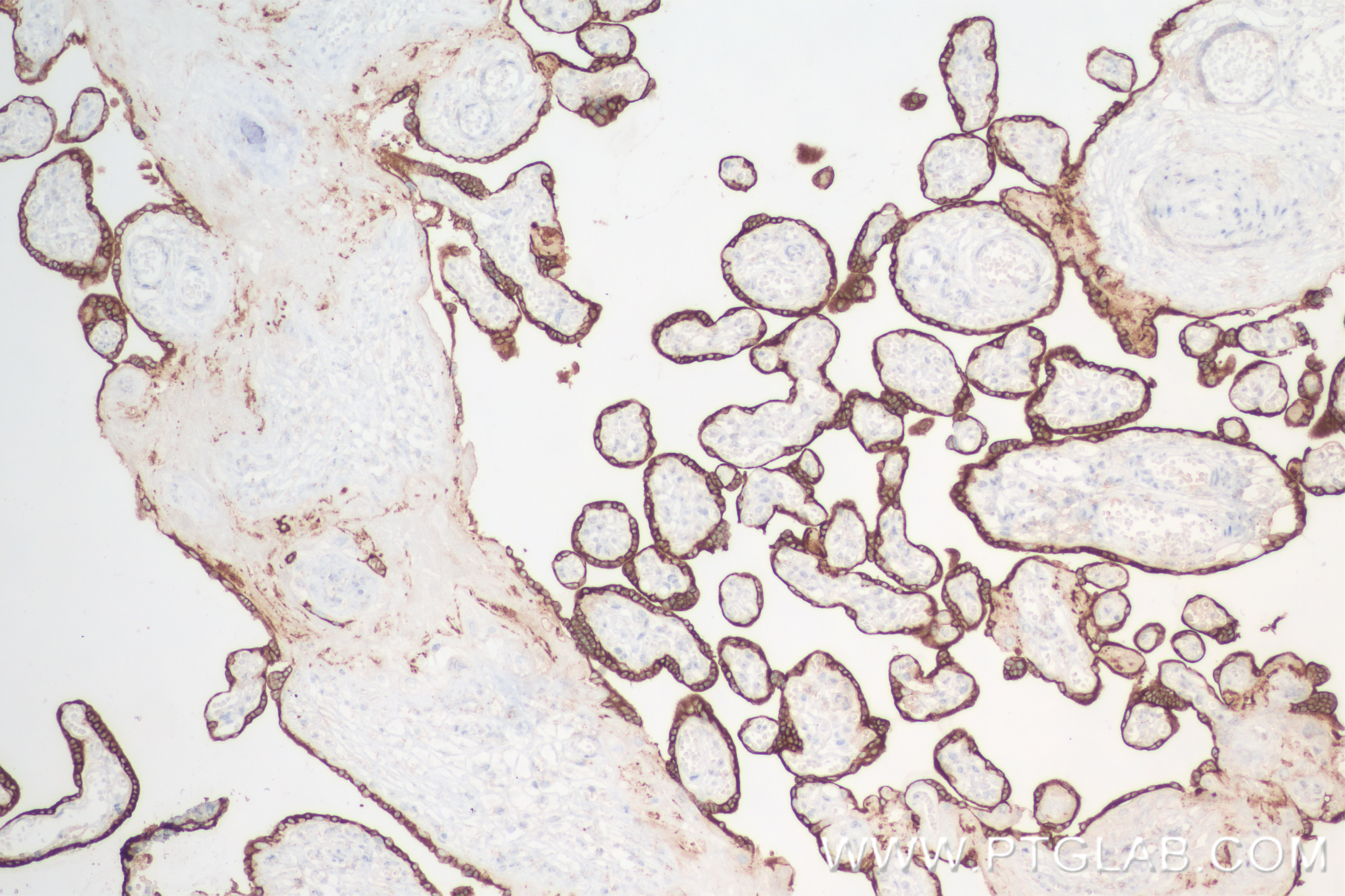 Immunohistochemistry (IHC) staining of human placenta tissue using Placental lactogen Recombinant antibody (84361-2-RR)