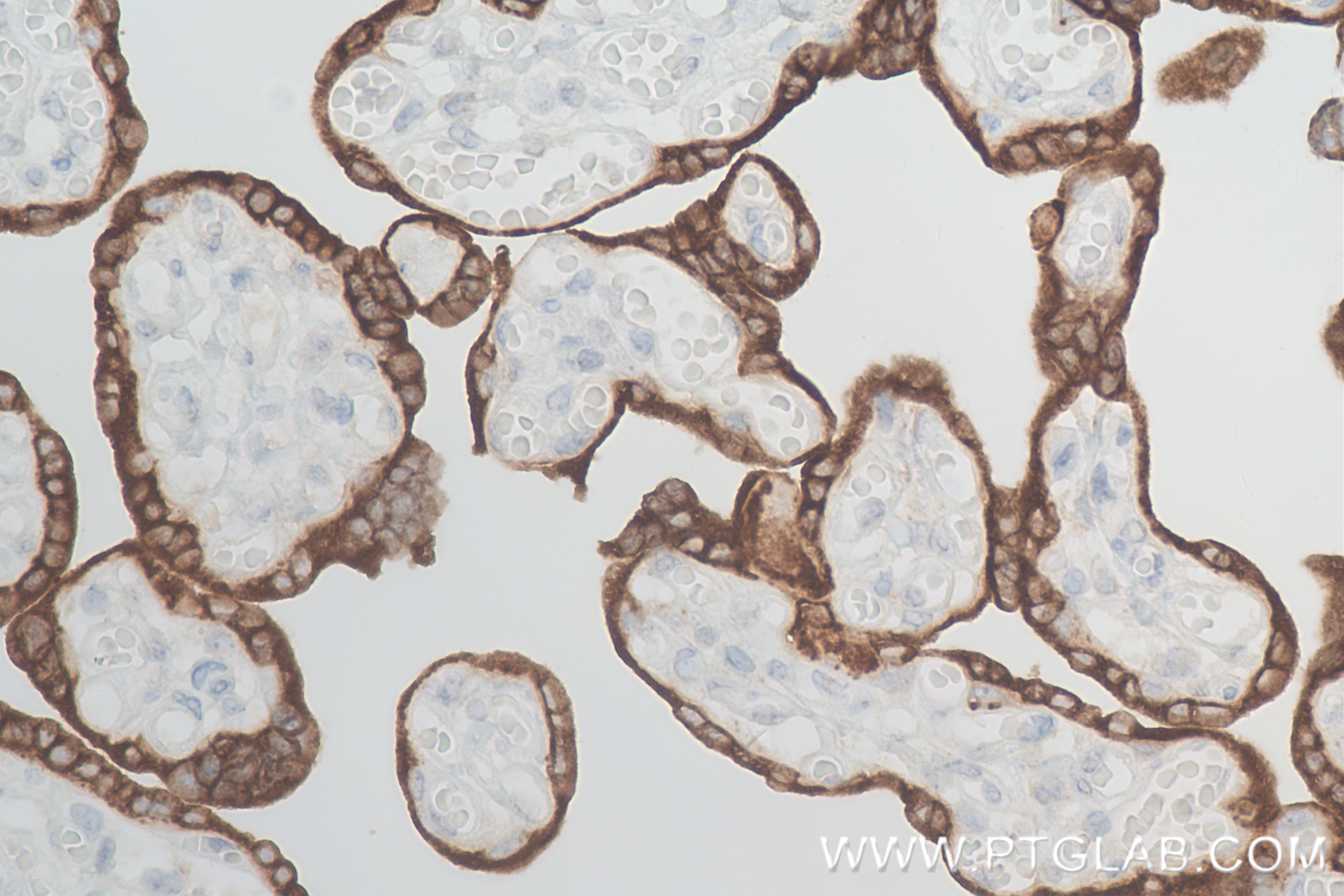 Immunohistochemistry (IHC) staining of human placenta tissue using Placental lactogen Recombinant antibody (84361-2-RR)