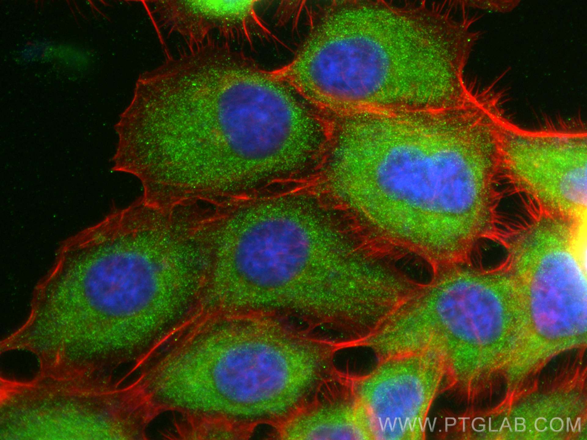 Immunofluorescence (IF) / fluorescent staining of A431 cells using CSK Polyclonal antibody (17720-1-AP)