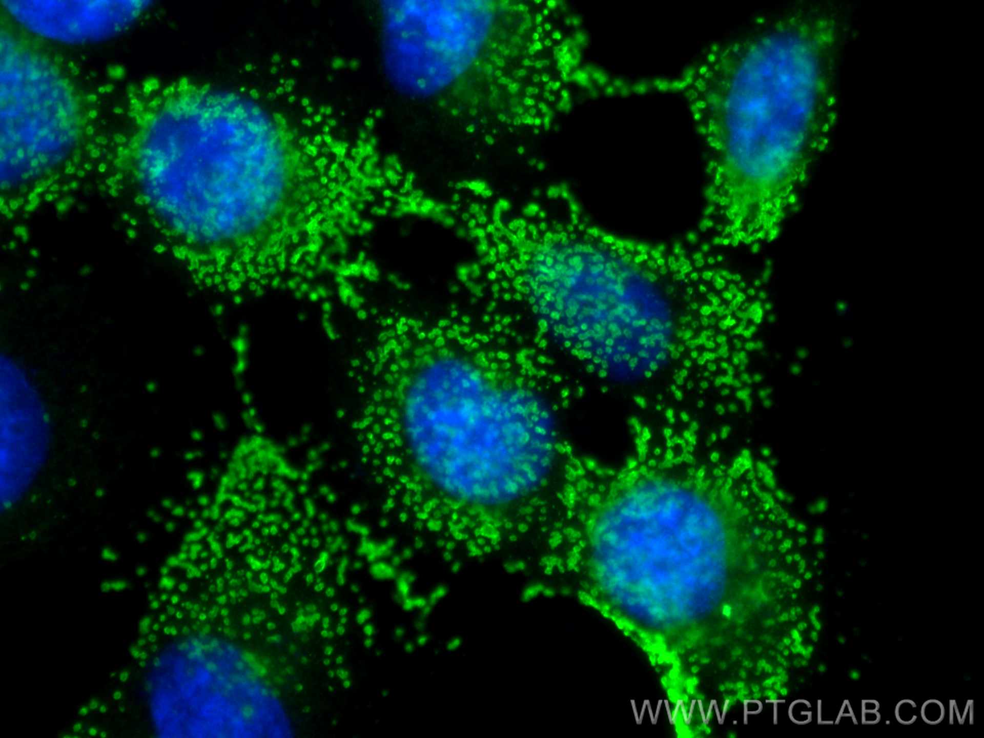 Immunofluorescence (IF) / fluorescent staining of A431 cells using CSK Monoclonal antibody (66115-1-Ig)