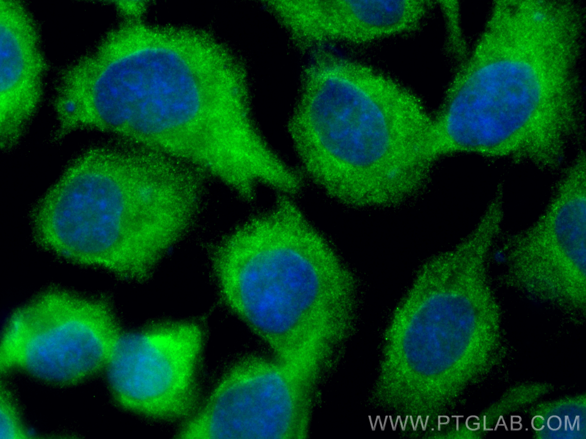 Immunofluorescence (IF) / fluorescent staining of A431 cells using CoraLite® Plus 488-conjugated CSK Polyclonal antib (CL488-17720)