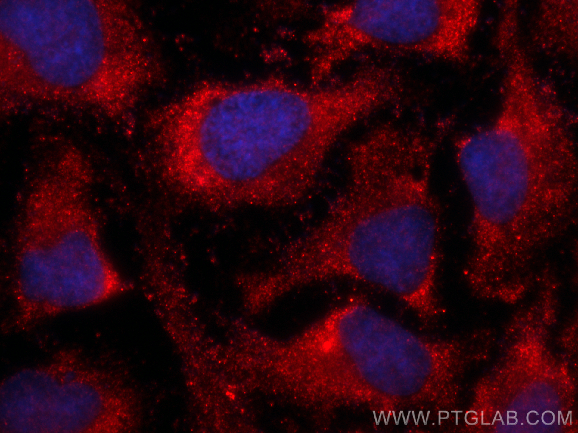 Immunofluorescence (IF) / fluorescent staining of HeLa cells using CoraLite®594-conjugated CSK Monoclonal antibody (CL594-66115)