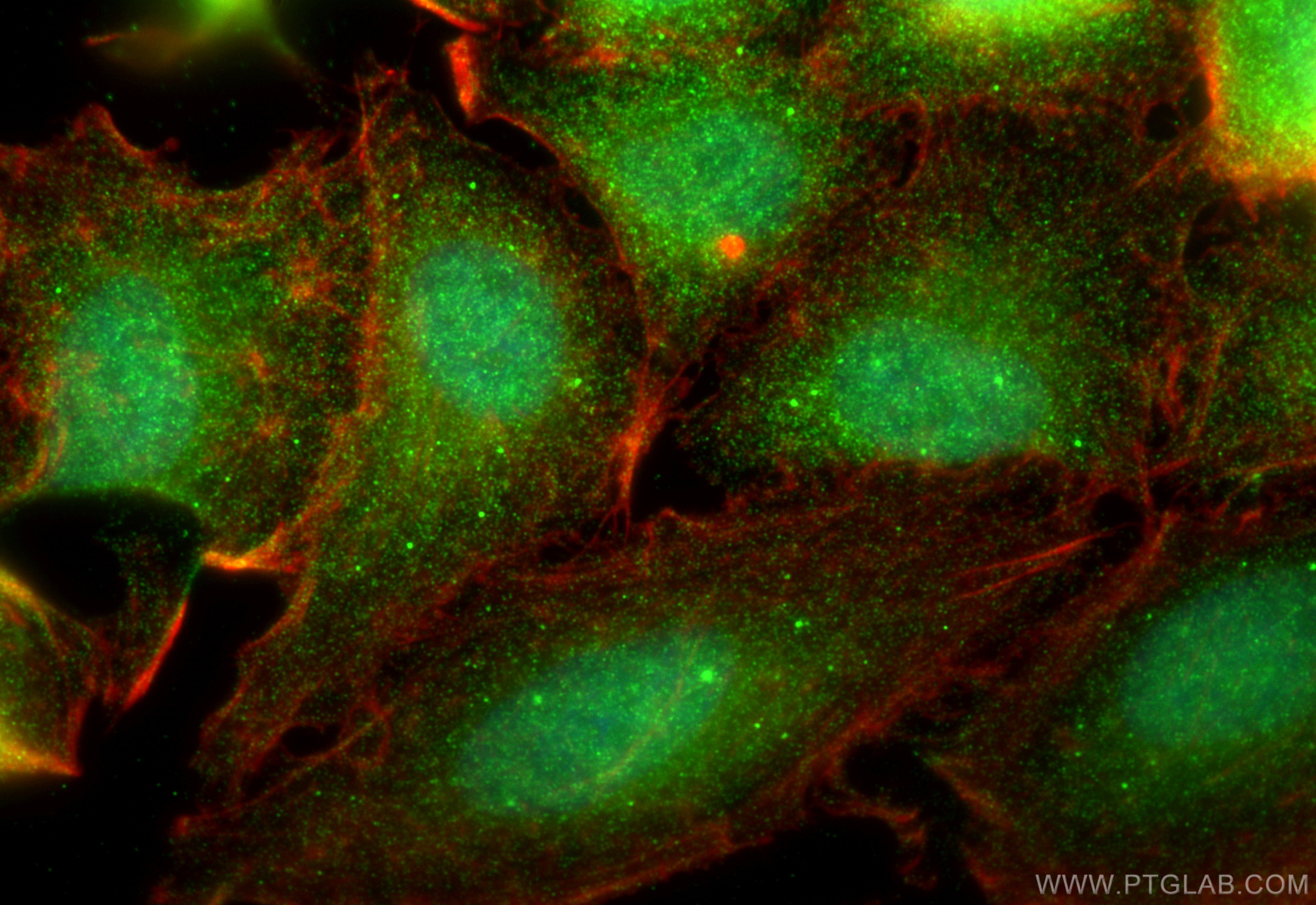 Immunofluorescence (IF) / fluorescent staining of A549 cells using CSNK1A1 Polyclonal antibody (55192-1-AP)