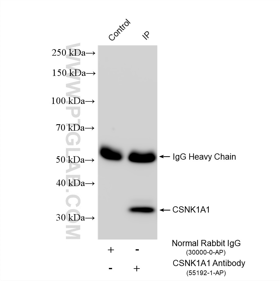 Immunoprecipitation (IP) experiment of HeLa cells using CSNK1A1 Polyclonal antibody (55192-1-AP)