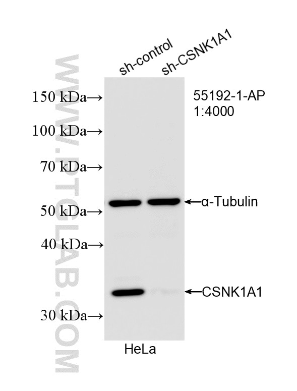 Western Blot (WB) analysis of HeLa cells using CSNK1A1 Polyclonal antibody (55192-1-AP)